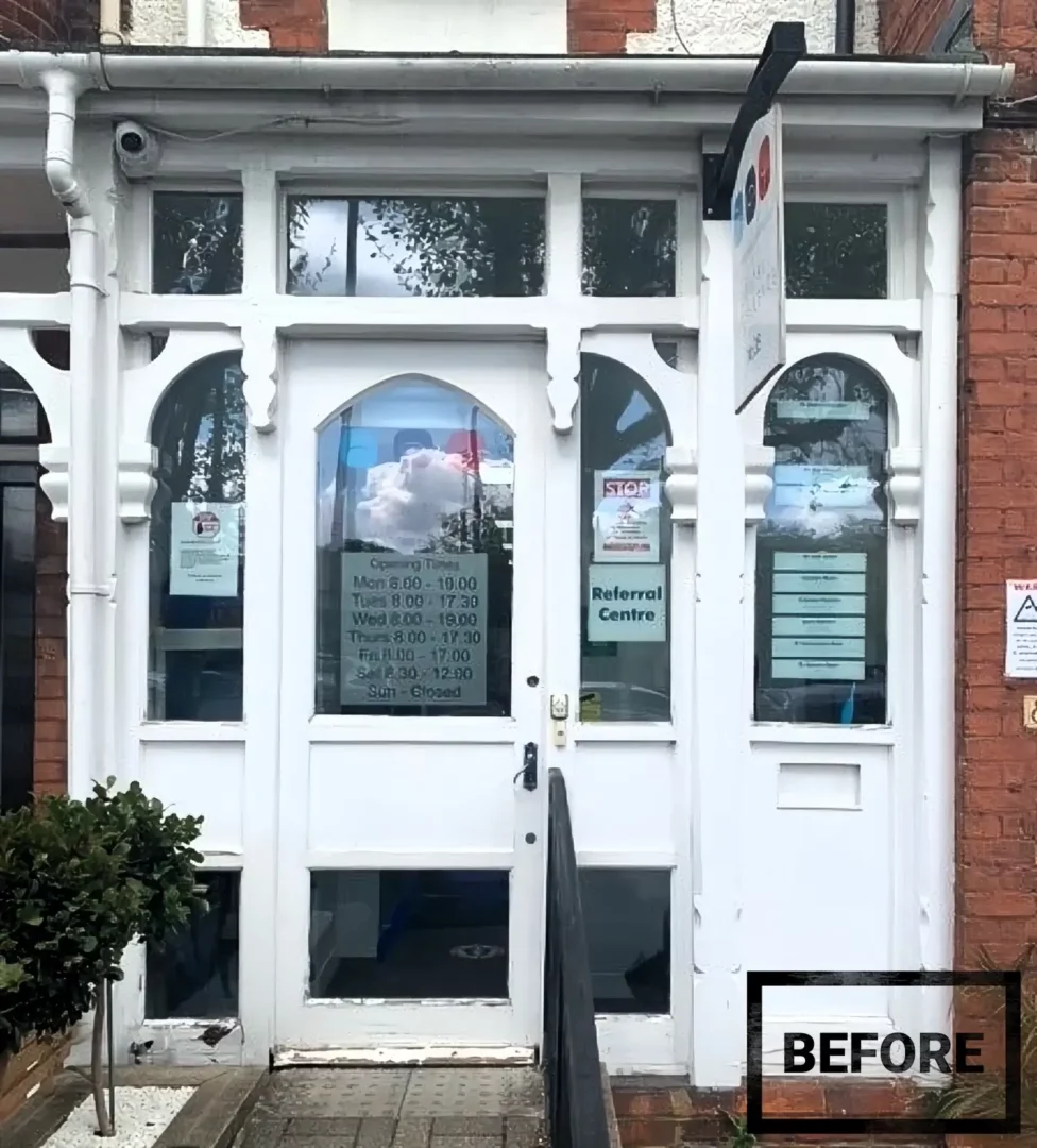 staines dental before - webp